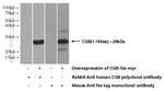 hCG beta Antibody in Western Blot (WB)