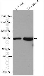 DDX28 Antibody in Western Blot (WB)