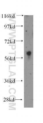 DDX28 Antibody in Western Blot (WB)