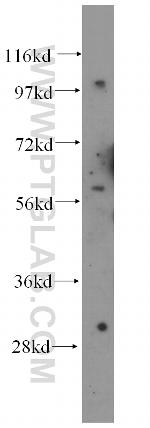 DDX28 Antibody in Western Blot (WB)