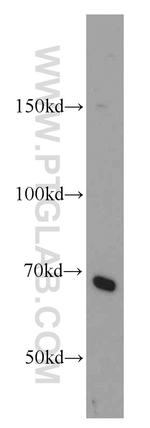 NEIL3 Antibody in Western Blot (WB)