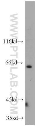 NEIL3 Antibody in Western Blot (WB)