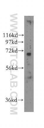 NEIL3 Antibody in Western Blot (WB)