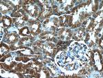 DOCK8 Antibody in Immunohistochemistry (Paraffin) (IHC (P))