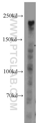 DOCK8 Antibody in Western Blot (WB)