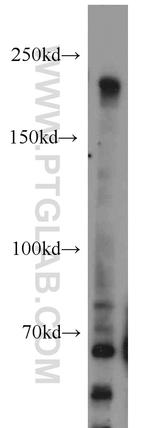 DOCK8 Antibody in Western Blot (WB)