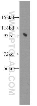 PRKD2 Antibody in Western Blot (WB)