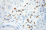 PRKD2 Antibody in Immunohistochemistry (Paraffin) (IHC (P))