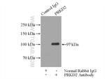 PRKD2 Antibody in Immunoprecipitation (IP)