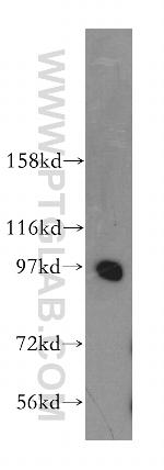 PRKD2 Antibody in Western Blot (WB)