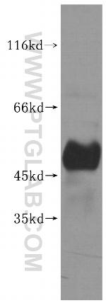 UHMK1 Antibody in Western Blot (WB)