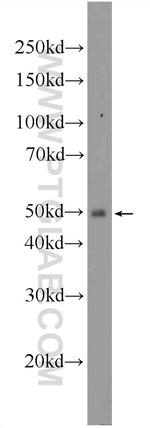 ENTPD6 Antibody in Western Blot (WB)