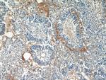 EPSTI1 Antibody in Immunohistochemistry (Paraffin) (IHC (P))