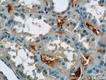 EPSTI1 Antibody in Immunohistochemistry (Paraffin) (IHC (P))