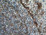 Podoplanin Antibody in Immunohistochemistry (Paraffin) (IHC (P))