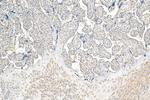 MIG6/ERRFI1 Antibody in Immunohistochemistry (Paraffin) (IHC (P))