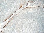 MIG6/ERRFI1 Antibody in Immunohistochemistry (Paraffin) (IHC (P))