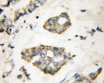 MIG6/ERRFI1 Antibody in Immunohistochemistry (Paraffin) (IHC (P))