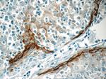 MIG6/ERRFI1 Antibody in Immunohistochemistry (Paraffin) (IHC (P))