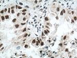 ZMYND8 Antibody in Immunohistochemistry (Paraffin) (IHC (P))