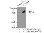 ZMYND8 Antibody in Immunoprecipitation (IP)