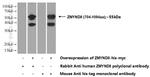 ZMYND8 Antibody in Western Blot (WB)