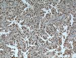 ZMYND8 Antibody in Immunohistochemistry (Paraffin) (IHC (P))