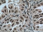 ZMYND8 Antibody in Immunohistochemistry (Paraffin) (IHC (P))