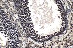 SF1 Antibody in Immunohistochemistry (Paraffin) (IHC (P))