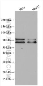 SF1 Antibody in Western Blot (WB)