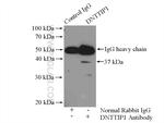 DNTTIP1 Antibody in Immunoprecipitation (IP)