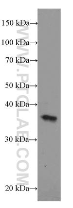 DNTTIP1 Antibody in Western Blot (WB)