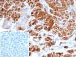 IL22RA2 Antibody in Immunohistochemistry (Paraffin) (IHC (P))