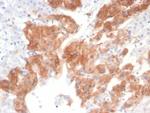 IL22RA2 Antibody in Immunohistochemistry (Paraffin) (IHC (P))