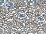 NPLOC4 Antibody in Immunohistochemistry (Paraffin) (IHC (P))