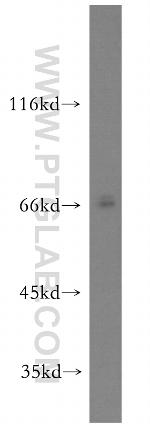 NPLOC4 Antibody in Western Blot (WB)