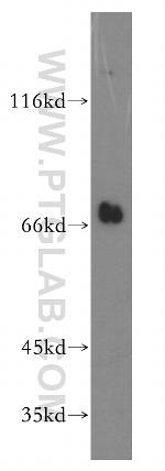 NPLOC4 Antibody in Western Blot (WB)