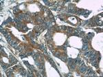 CDC6 Antibody in Immunohistochemistry (Paraffin) (IHC (P))