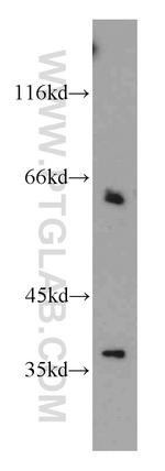 CDC6 Antibody in Western Blot (WB)