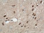 CDC6 Antibody in Immunohistochemistry (Paraffin) (IHC (P))