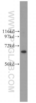 CDC6 Antibody in Western Blot (WB)