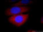 GNAI3 Antibody in Immunocytochemistry (ICC/IF)