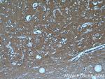 GNAI3 Antibody in Immunohistochemistry (Paraffin) (IHC (P))