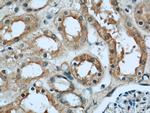 GNAI3 Antibody in Immunohistochemistry (Paraffin) (IHC (P))