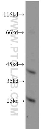 GNAI3 Antibody in Western Blot (WB)