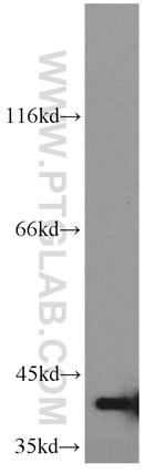 GNAI3 Antibody in Western Blot (WB)