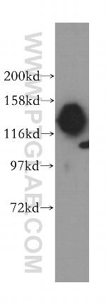 SAFB2 Antibody in Western Blot (WB)