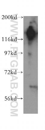 SAFB2 Antibody in Western Blot (WB)