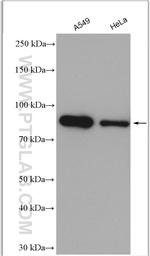 Gelsolin Antibody in Western Blot (WB)