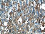 Gelsolin Antibody in Immunohistochemistry (Paraffin) (IHC (P))